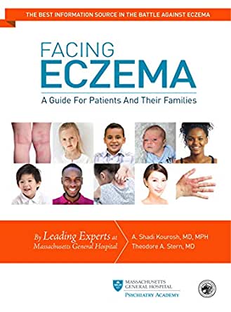 Facing Eczema